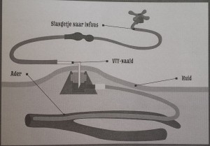 schematische weergave PAC